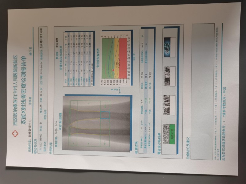 雙能X射線骨密度儀報告單